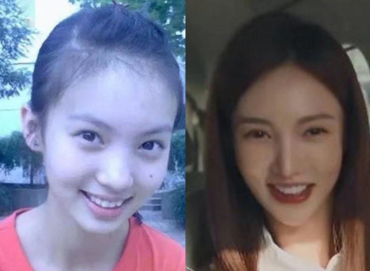 金晨整容前后对比照片 金晨就是一张整容失败的脸