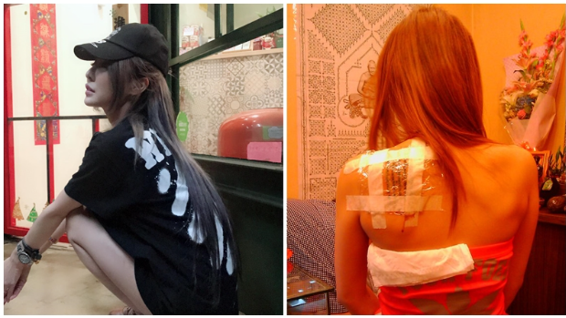 性感女星整容出事！ 双眼出现异常情况，贴恐怖照片曝付出很大代价