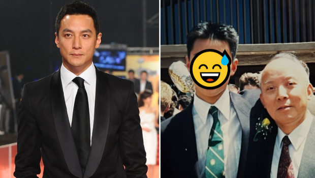 吴彦祖曾是痘痘男！无P学生照泄“多颗痤疮”引热议