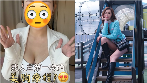 前港姐返内地变样撞脸迪丽热巴？自曝因羡慕姐姐身材去丰胸
